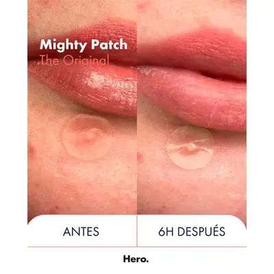 HERO COSMETICS Mighty patch the original 24uds 